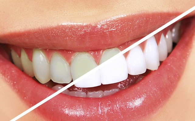 estetica dentale verona